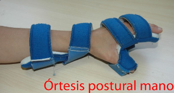 ortesis-postural-mano